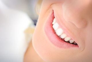 Blanqueamiento Dental + Limpieza, en A&V Dental Providencia