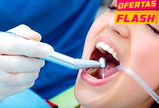 Limpieza Dental + Destartraje con Ultrasonido + Profilaxis