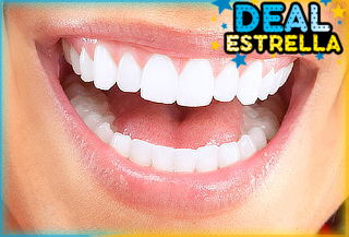 Limpieza Dental y Blanqueamiento, Providencia