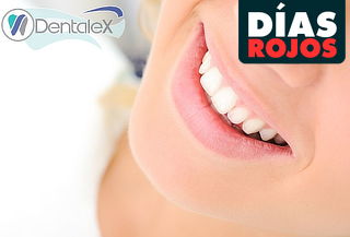 ¡Salud Bucal! Limpieza Dental + Destartraje + Profilaxis