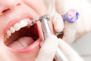 ¡Limpieza Dental! Detartraje con Ultrasonido + Pulido y Más