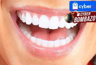 Limpieza Dental y Blanqueamiento, Providencia