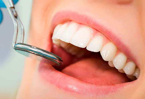 Limpieza con Destartraje o Blanqueamiento Dental