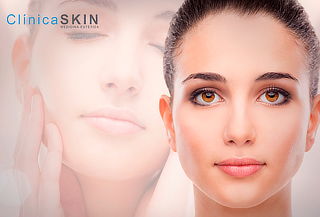 1 s. Limpieza Facial con Microdermoabrasión, Clínica Skin