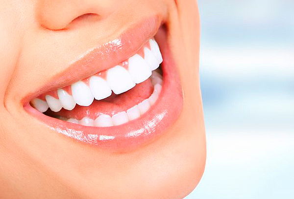 Limpieza Dental con Destartraje y Topicación de Flúor