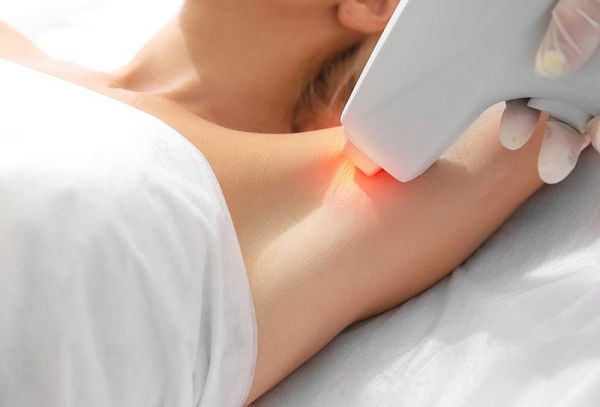 Contraindicaciones de la depilacion laser diodo