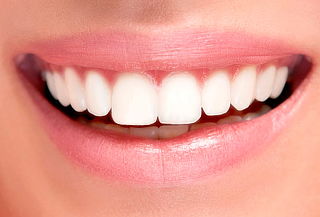 Bono para 1, 2, 3 o 4 implantes de titanio