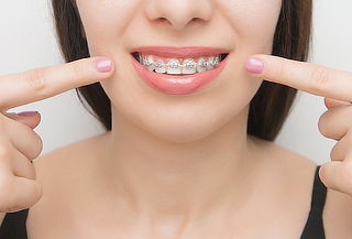 Paga $4.990 en Instalación de Brackets Metálicos+Limpieza