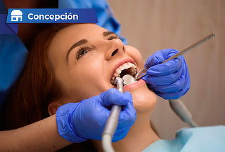 Destartraje Supragingival + Pulido Coronario + 2 Rx BiteWing