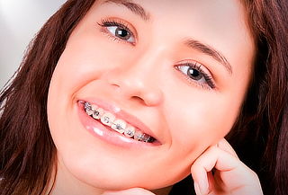 Ortodoncia con Brackets metálicos: Dental Center