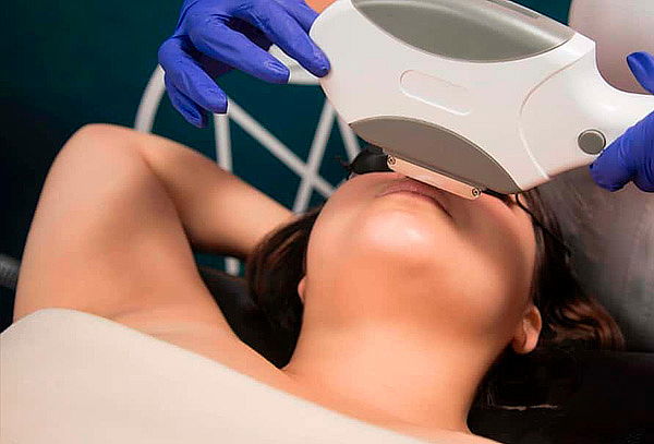 6 Sesiones Depilación Laser en 7 Zonas
