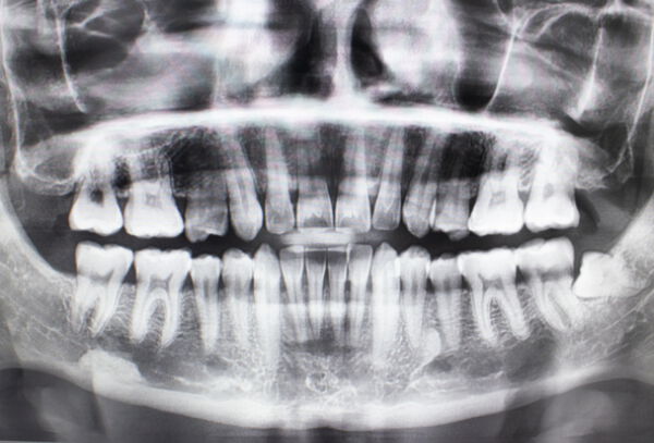 Radiografía Panorámica + Evaluación Odontológica