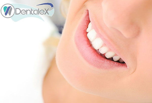 ¡Salud Bucal! Limpieza Dental + Destartraje + Profilaxis