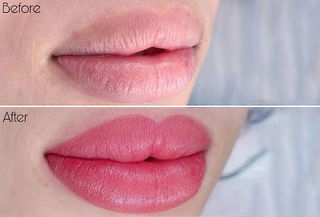 Micropigmentacion de labios en Blue la Serena 