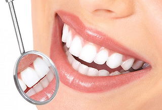 Limpieza Dental: Destartraje + Profilaxis + Flúor. 