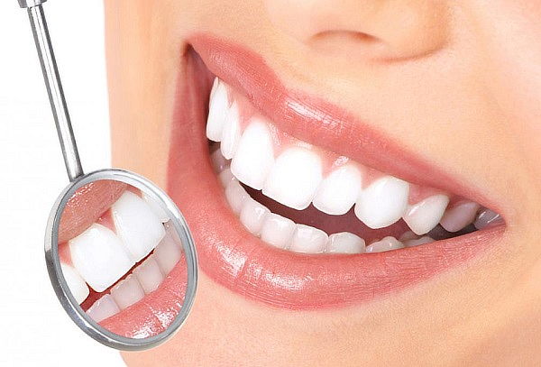 Limpieza Dental: Destartraje + Profilaxis + Flúor. 
