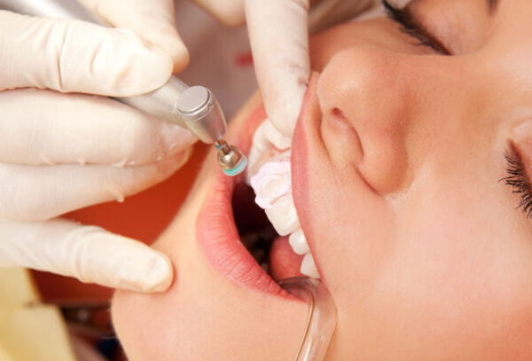 Evaluación + Profilaxis Dental en Clínica B&M