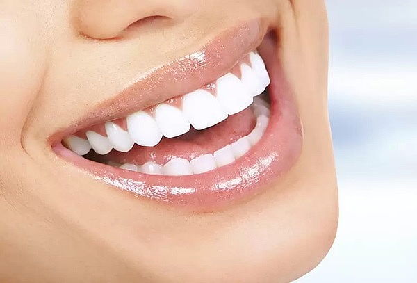 Blanqueamiento + Limpieza Dental + Pulido Coronario