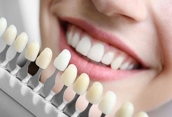 Blanqueamiento + Limpieza Dental + Pulido Coronario
