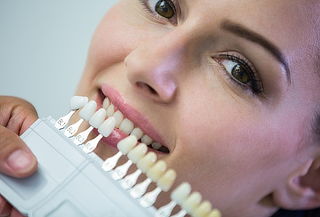 Carilla Dental Directa de Alta Estética