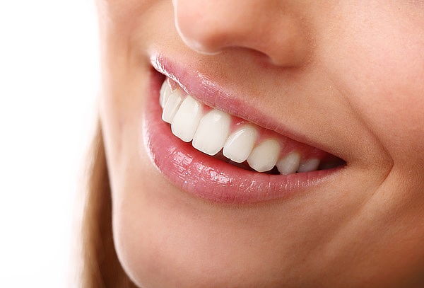 Carilla Dental Directa de Alta Estética