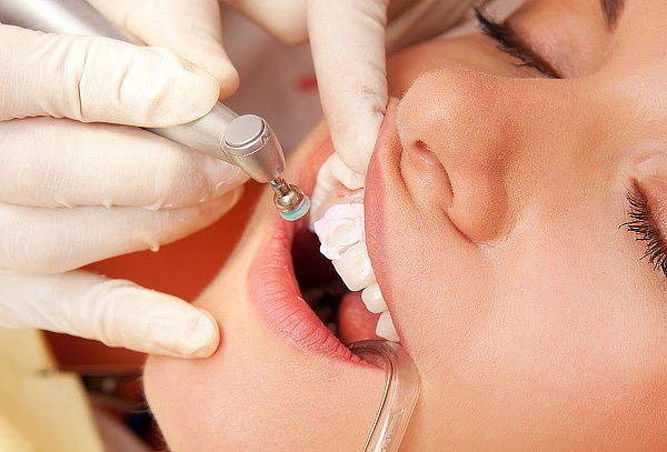 Limpieza Dental + Blanqueamiento + Flúor + Diagnóstico