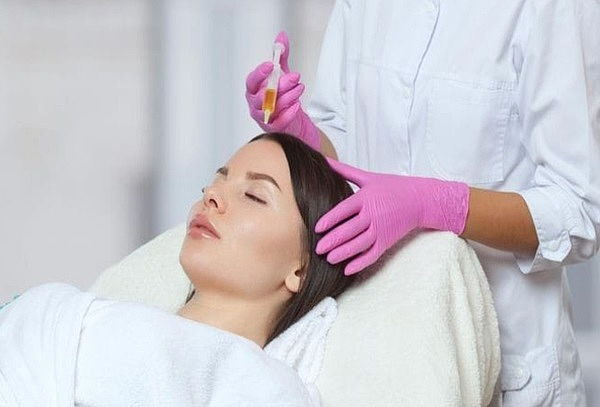 Plasma  Capilar para  Alopecia  y perdida de cabello