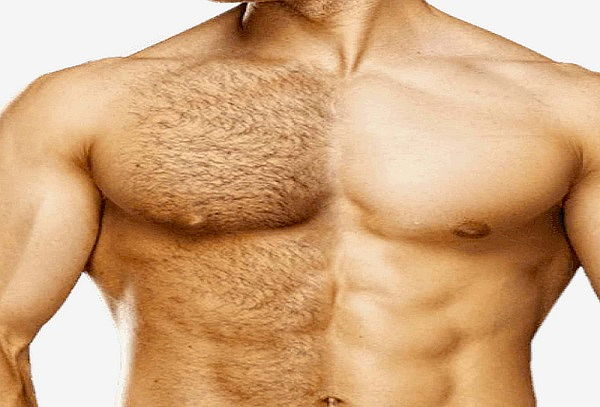 Depilación Masculina Verano , 3 zonas a elección 