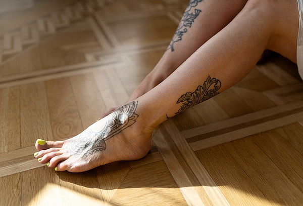 Remoción de Tatuajes, Color Negro 6 cm x 6 cm con Laser YAG