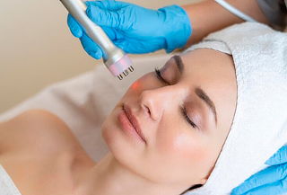 Radiofrecuencia en Rostro Completo (5 zonas)