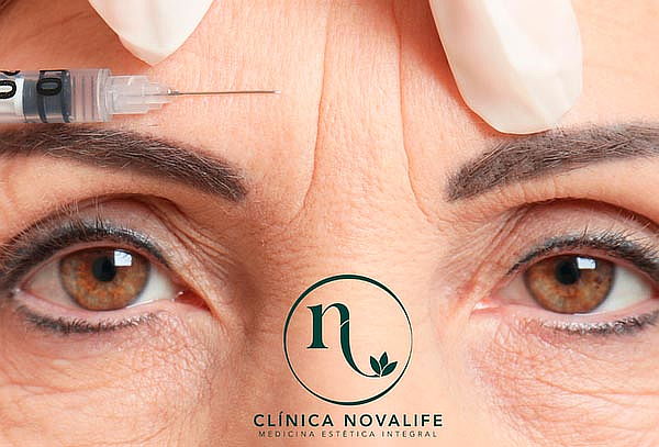 Rejuvenece tu Rostro con Toxina Botulínica en Novalife