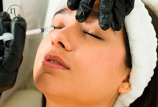 Rejuvenece tu Rostro con Toxina Botulínica en Novalife