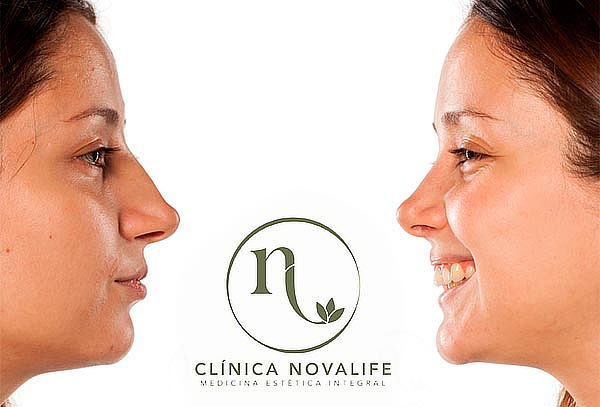 1, 2 o 3 Sesiones de Mesoterapia Pink Glow en Novalife