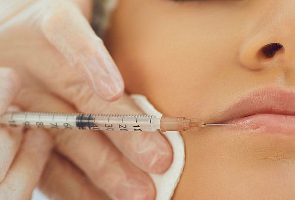 Armonización de Labios con Ácido Hialurónico en Novalife