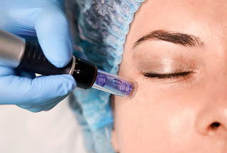 Blefaroplastia Sin Cirugía con Plasma Pen en Clínica Haru