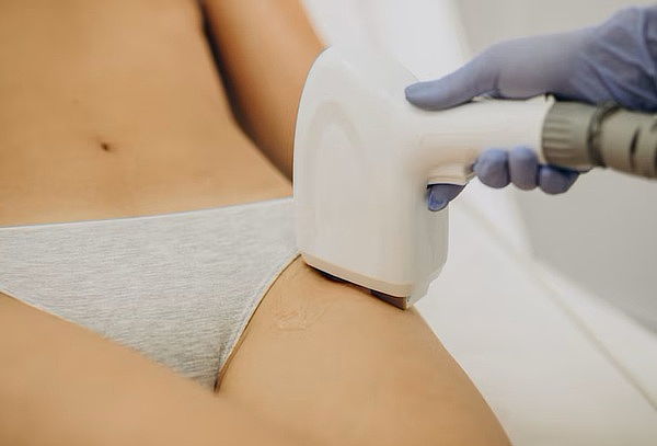 6 Sesiones de depilación laser Diodo rebaje y axilas