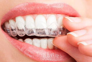 Plano De Relajación Dental + Caja Protectora 