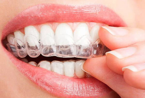 Plano De Relajación Dental + Caja Protectora 