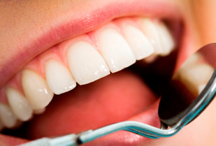 90% Blanqueamiento Dental en Providencia