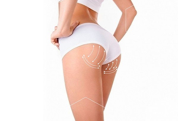 Levantamiento de Glúteos Full con Vitamina C