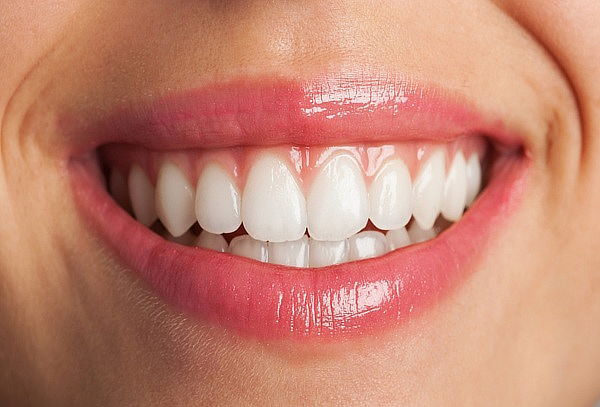 Blanqueamiento Led + Limpieza Dental Completa