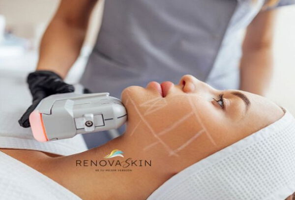 1 sesión HIFU Coreano  + Terapia Celluma Pro, ¡Adiós Papada!