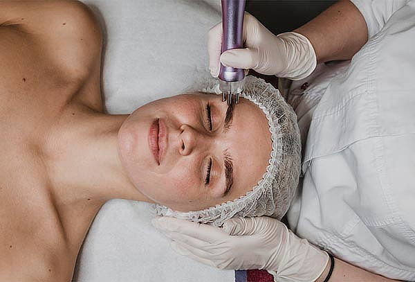 Inducción de vitaminas con derrapen,limpieza facial profunda