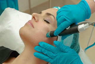 Limpieza Facial Profunda con Microdermoabrasión y mas