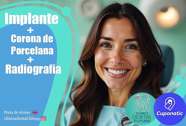 Implante + Corona de porcelana + Radiografía 