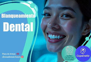 Blanqueamiento dental, clinica dental futuro, Santiago. 
