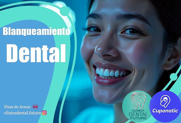 Blanqueamiento dental, clinica dental futuro, Santiago. 