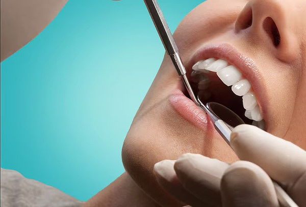 Limpieza Dental: Destartraje + Diagnostico  1 o 2 personas