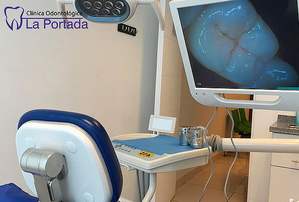 Blanqueamiento Led + Limpieza Dental Completa