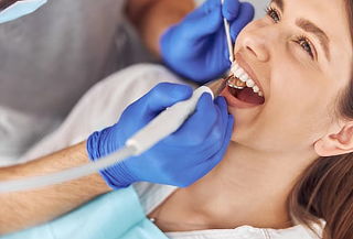 Limpieza Dental: Destartraje + Pulido  + Evaluación.